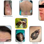 The Root Causes of Skin Conditions: A Holistic Approach to Treating Psoriasis, Vitiligo, and Warts