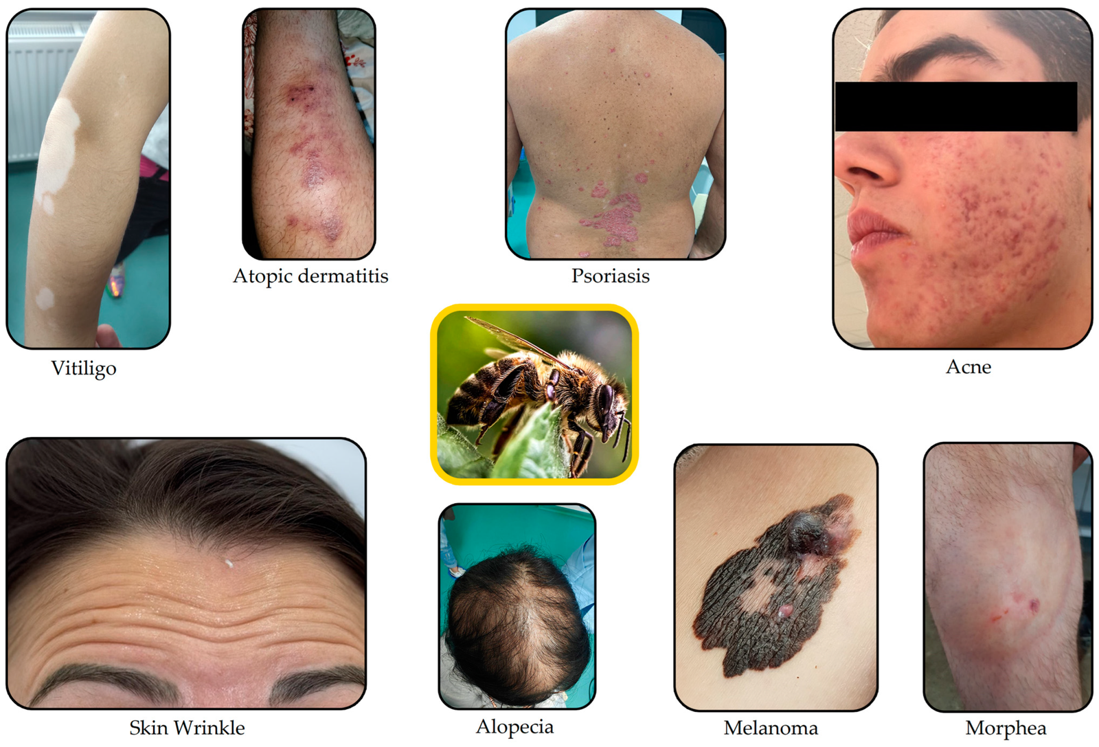 Read more about the article The Root Causes of Skin Conditions: A Holistic Approach to Treating Psoriasis, Vitiligo, and Warts